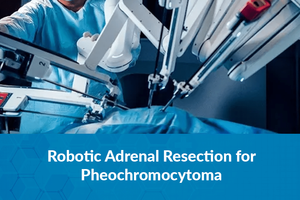 Robotic Adrenal Resection for Pheochromocytoma