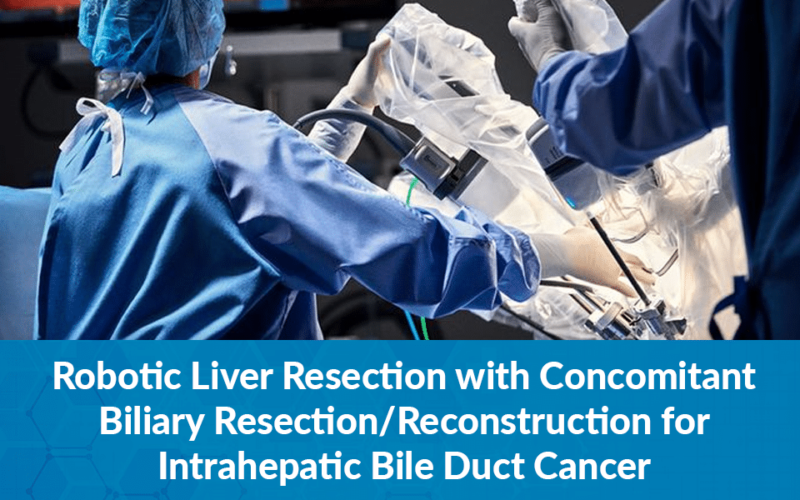 Robotic Liver Resection with Concomitant Biliary Resection/Reconstruction for Intrahepatic Bile Duct Cancer