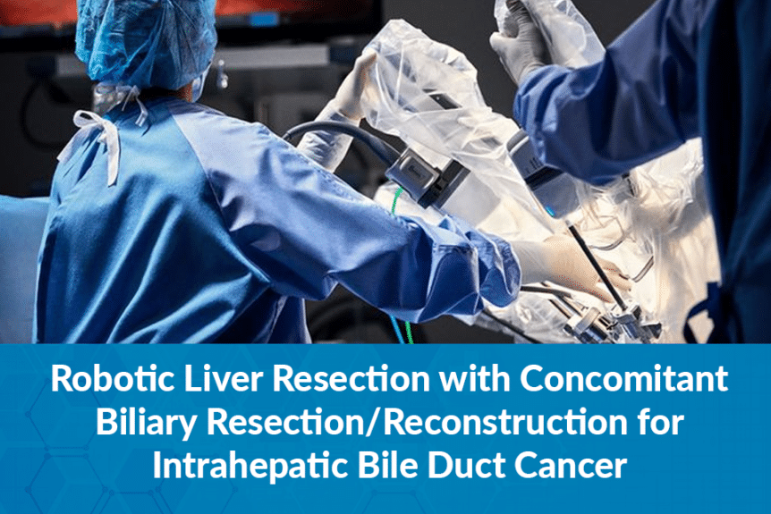 Concomitant Biliary Resection for Intrahepatic Bile Duct Cancer