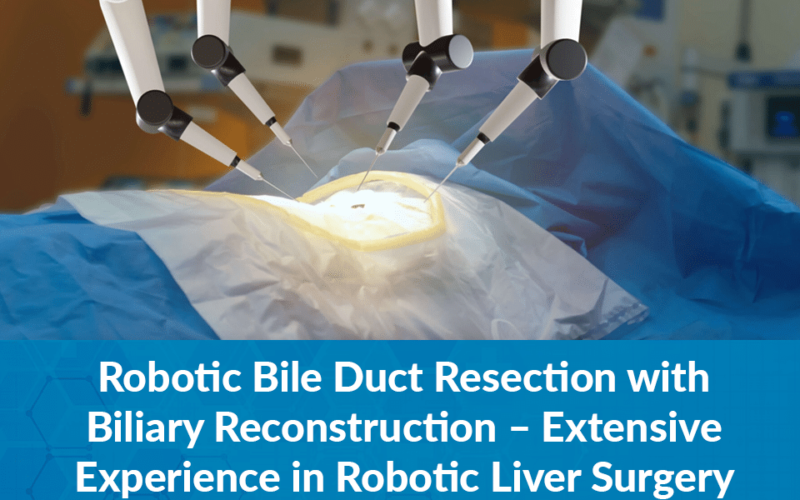 Robotic Bile Duct Resection with Biliary Reconstruction – Extensive Experience in Robotic Liver Surgery